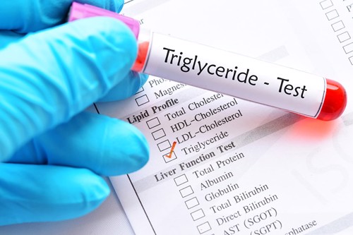 Chỉ số triglyceride cao và các biến chứng cần đề phòng